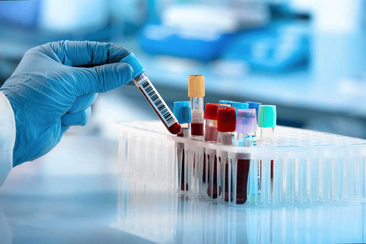 Descubra como é feito o diagnóstico e o tratamento da Escherichia coli